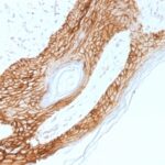 FFPE human skin sections stained with 100 ul anti-E-Cadherin / CD324 (clone 4A2) at 1:50. HIER epitope retrieval prior to staining was performed using 10mM Citrate, pH 6.0.